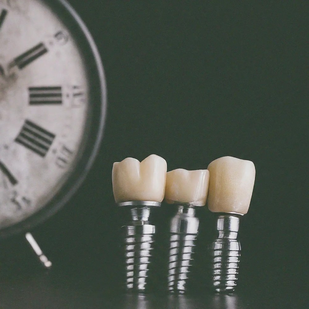 How Long Do Dental Implants Last?