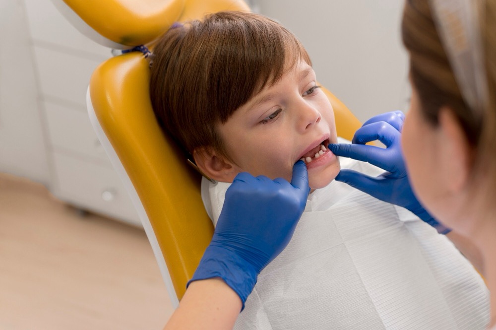 What Parents in Reston, VA Should Know About Fluoride Treatments for Kids