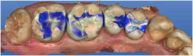 a man with a toothbrush in his mouth  at pediatric dentistry Reston in Reston, VA