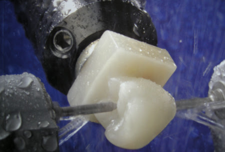 CEREC close-up at Reston Family Dental in Reston, VA