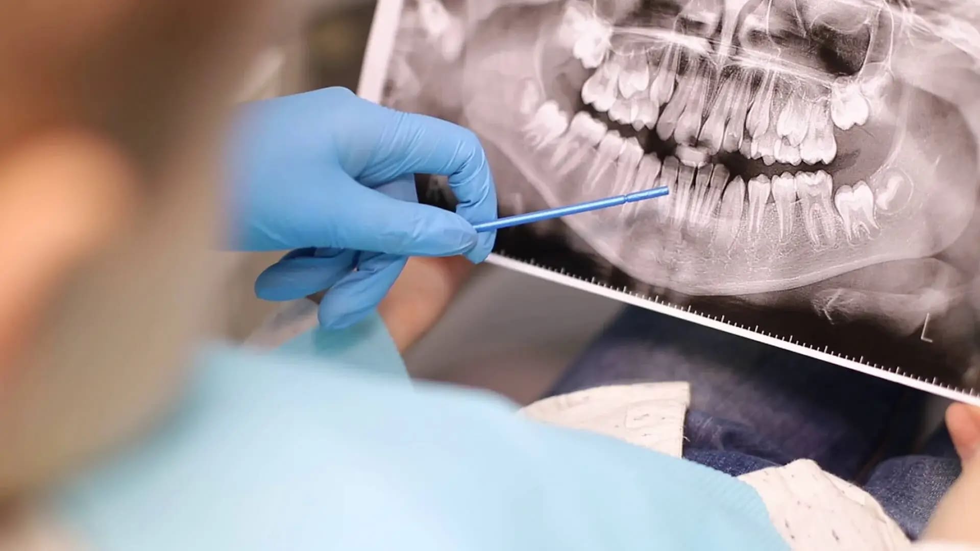 a person is cutting a piece of paper with a pair of scissors  at family dentistry in Reston, VA